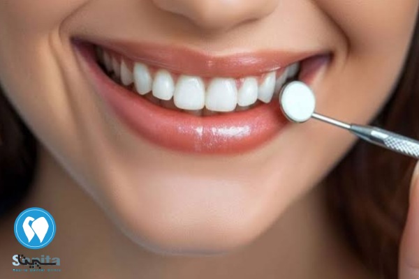 قیمت کامپوزیت کر ایتالیا