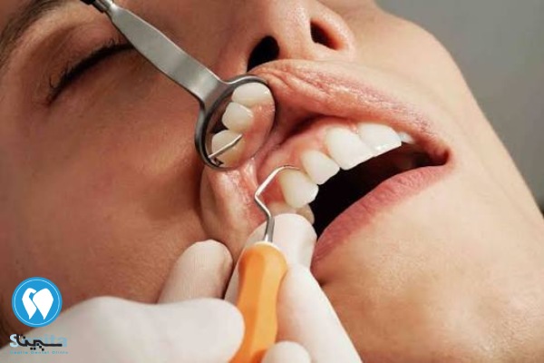 تخصص دندانپزشکی ترمیمی و زیبایی چند سال است؟