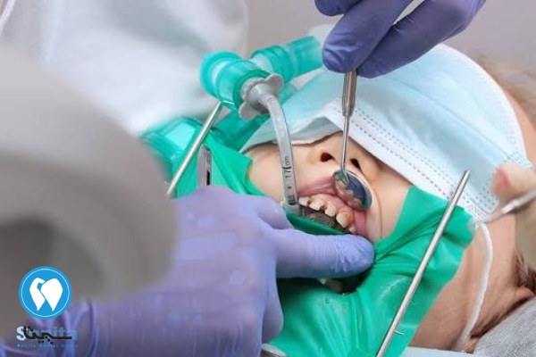 توصیه های قبل از دندانپزشکی اطفال تحت بیهوشی