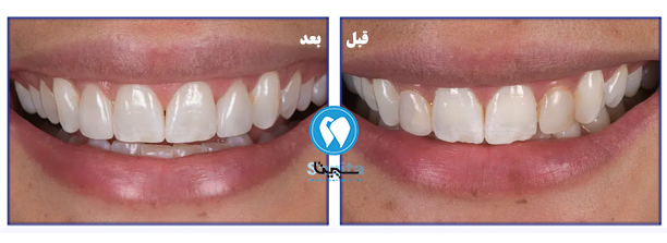 عکس طرح لبخند