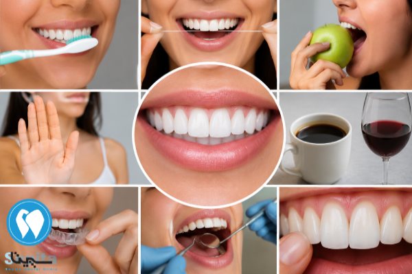 مراقبت های بعد از لمینت دندان خرگوشی