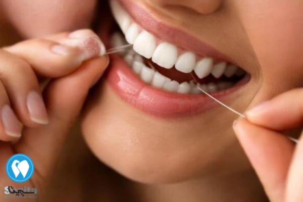 مسواک و نخ دندان برای دوام لمینت 
